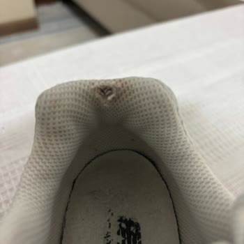 New Balance 740 Ayakkabısında Erken Topuk Aşınması Ve Ayak Ağrısı İade Talebi