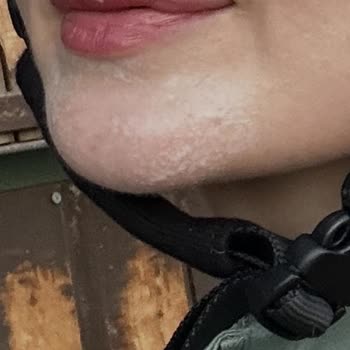 Yves Rocher Ürünlerinden Şiddetli Cilt Tahrişi Ve Cevapsız Müşteri Hizmetleri
