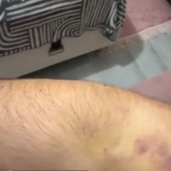 Türk Kızılay Dikkatsizliği Sonucu Yaşadığım Mağduriyet