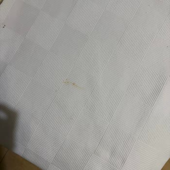 Grand Avşa Otelinde Hijyen Sorunları Ve Sıcak Su Eksikliği