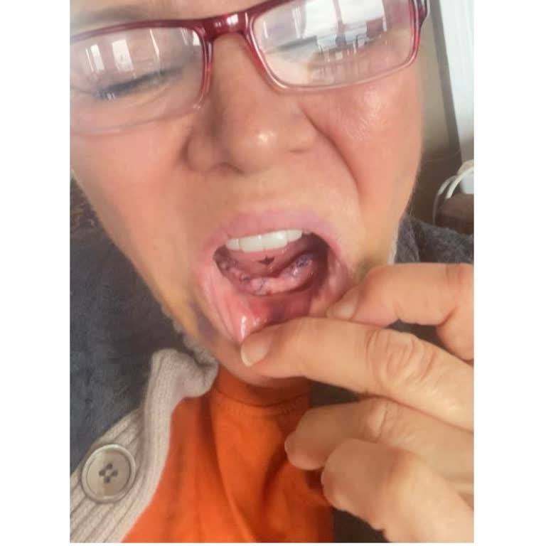 Dr. Deniz Çalışkan Ağız Ve Diş Sağlığım Ciddi Şekilde Zarar Gördü