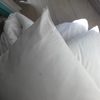 Long Beach Resort'ta Temizlik, Böcek Ve Güvenlik Sorunlarıyla Tatil Keyfi Yok