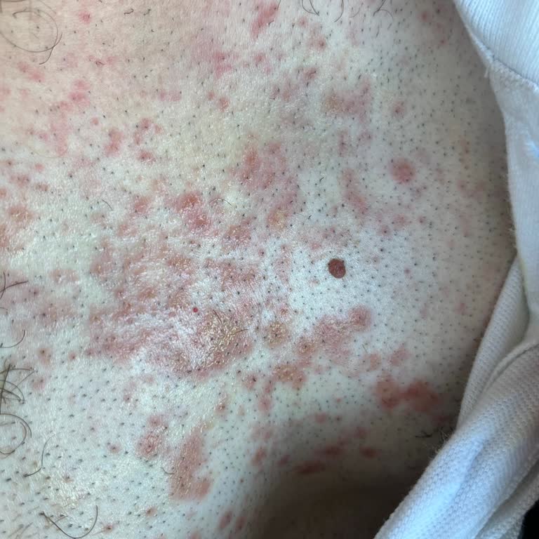 Watsons Tüy Dökücü Spreyi Ciltte Şiddetli Yanma Ve Tahriş Yarattı, İade İstiyorum