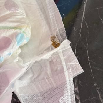 Molfix Bebek Bezinde Yabancı Madde Görülmesi Güven Sorunu