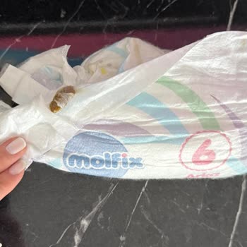 Molfix Bebek Bezinde Yabancı Madde Görülmesi Güven Sorunu