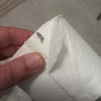 Papia Tuvalet Kağıdında Siyah Lekeli Rulo: Hijyen İhlali Ve Acil İnceleme Talebi