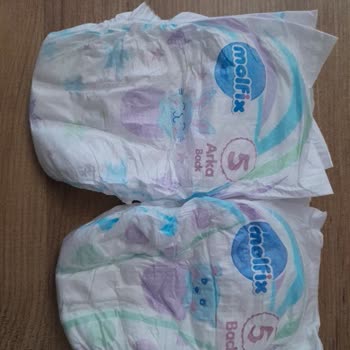 Molfix 5 Numaralı Bebek Bezinde DZ26 Partisinde Ölçü Ve Doku Farkı