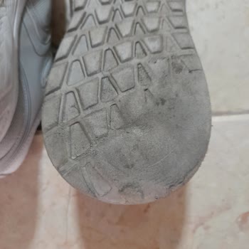 Ayakkabının Topuğu Dıştan Aşırı Deforme