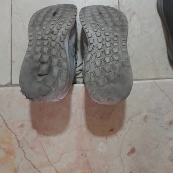 Ayakkabının Topuğu Dıştan Aşırı Deforme