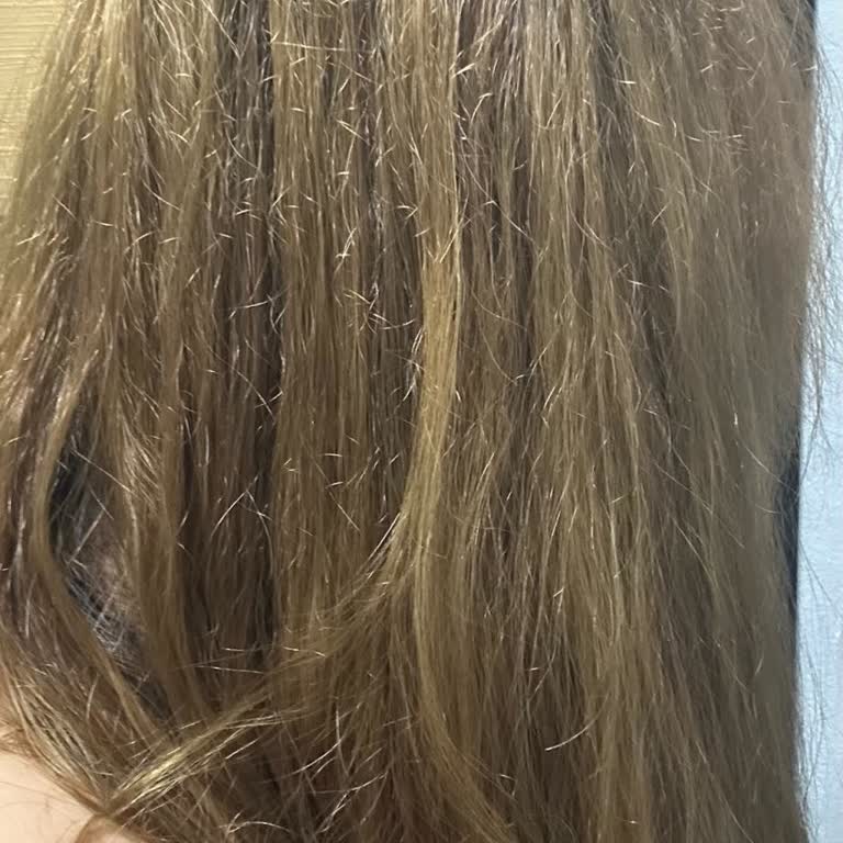 Uğurcan & Şahin Hair | Kuşadası Hatalarını Kabul Etmediler ve Sorumluluk Almadılar