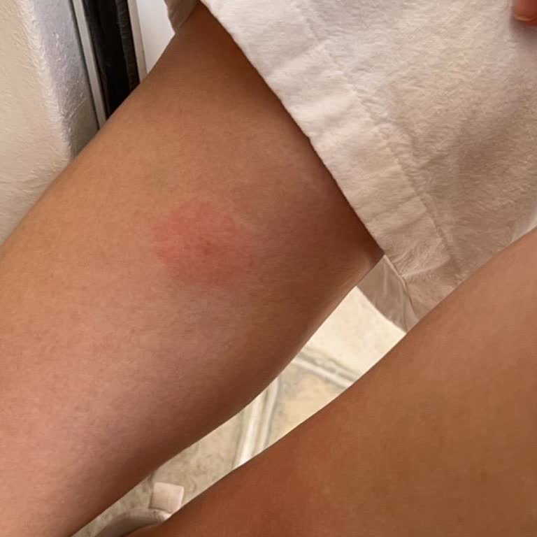 Ayvalık Pansiyonunda Bilgi Yanıltma Ve Kötü Oda Koşulları İade Talebi