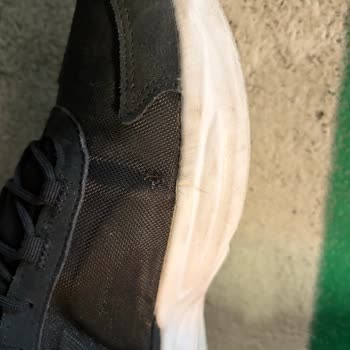Adidas Ayakkabısının Kısa Sürede Açılması Ve Amazon’un Sorumluluk Reddi