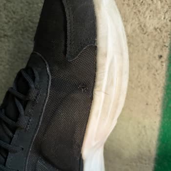 Adidas Ayakkabısının Kısa Sürede Açılması Ve Amazon’un Sorumluluk Reddi