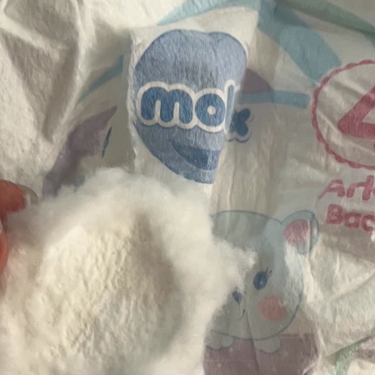 Molfix Bebek Bezinde Yabancı Cisim: Sağlık Endişesi Ve Güven Kırılması