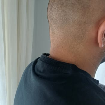 Yaka Katlanması Sorunu: Ürün Değişimi Ve İade Talebi