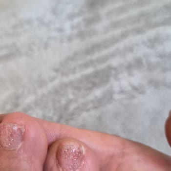 Hijyenik Olmayan Ve Kalitesiz Manikür Deneyimi