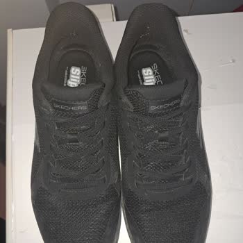 Skechers Spor Ayakkabıda Aşırı Terleme, Deformasyon Ve İade Talebi