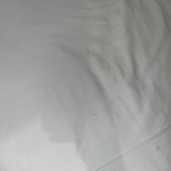 Dolce By Wyndham’da Hijyen Ve Hizmet Çöküşü