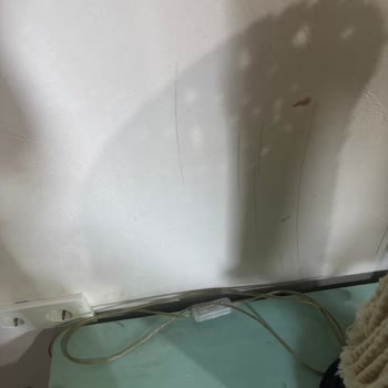 Hijyen Eksikliği Ve Su Kesintisi Nedeniyle Otelde Konaklama İadesi Talebi