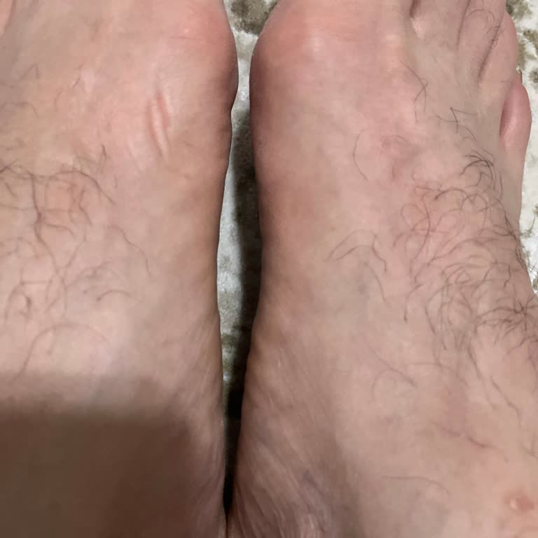 Ayak Ağrısı Ve Şekil Bozukluğu Nedeniyle Asics Gel-1130 Değişim Talebi Reddedildi