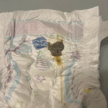 Molfix Bebek Bezlerinde Koyu Kahverengi Lekeler Ve Sağlık Endişesi