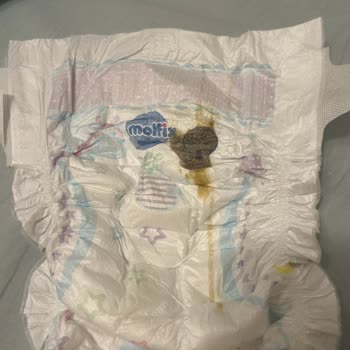 Molfix Bebek Bezlerinde Koyu Kahverengi Lekeler Ve Sağlık Endişesi