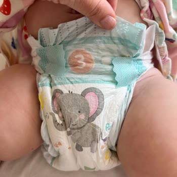 Prima Aktif Bebek 3 Numaralı Bezde Sürekli Çiş Sızdırma