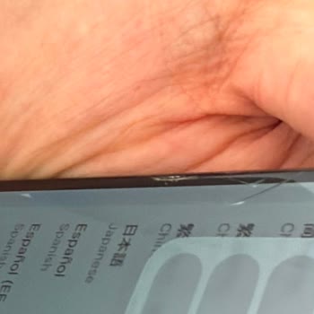 Kırık Telefon Ve Eksik Kutu İçin Hızlı İade Talebi