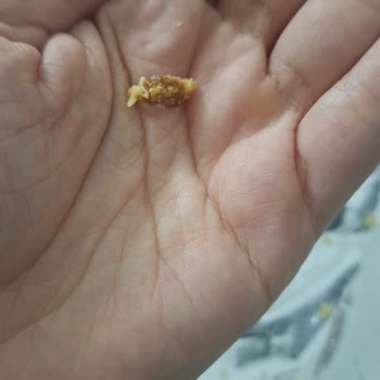 Çerezza Biftek Soğan Aromalı Cipste Yabancı Madde Ve Sağlık Riski