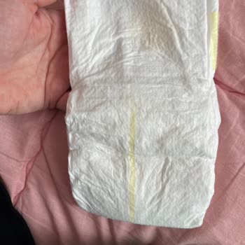 Şok'tan Aldığım Prima Bebek Bezinin Sahte Olduğu Şüphesi Ve Geri Ödeme Talebi