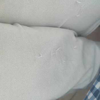 Tüylenen Pantolonlar İçin İade Ve Değişim Talebim