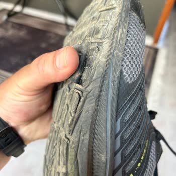 Skechers Ayakkabısında Üretim Kusuru Ve Haksız Kullanıcı Hatası İddiası