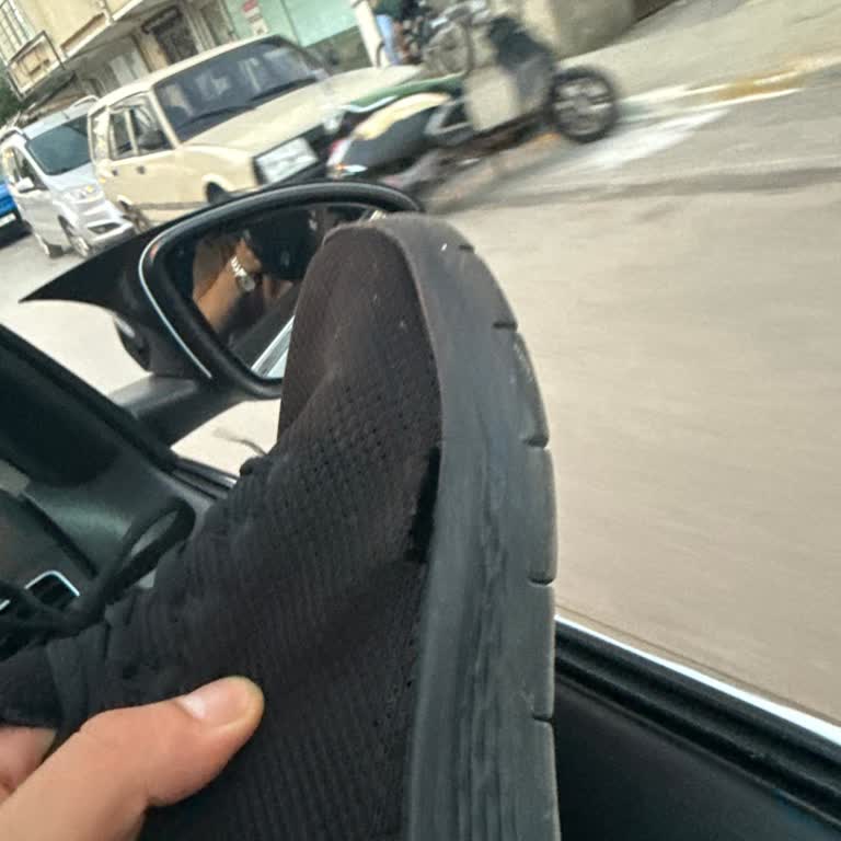 Üretim Hatası Olan Skechers Ayakkabısı Kullanıcı Hatası Olarak Değerlendirilmemeli