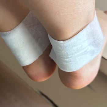 Marcatelli'nin Saten Topuklu Ayakkabısı Deri Yara Ve İade Reddi