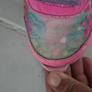 Skechers Unicorn Ayakkabısında Kısa Sürede Ön Burun Açılması Ve İade Talebi