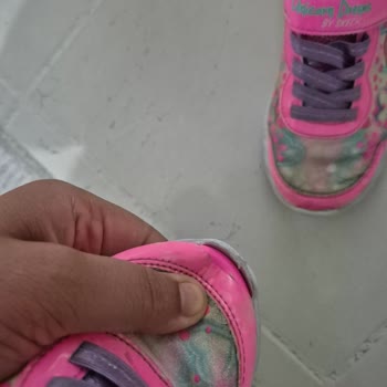 Skechers Unicorn Ayakkabısında Kısa Sürede Ön Burun Açılması Ve İade Talebi