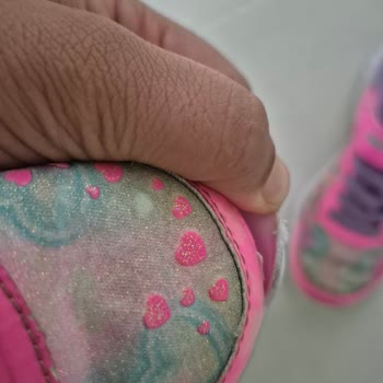 Skechers Unicorn Ayakkabısında Kısa Sürede Ön Burun Açılması Ve İade Talebi
