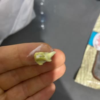 Sek Markasının Quark Ürününde Yabancı Cisim Ve Bozulma Şikayeti
