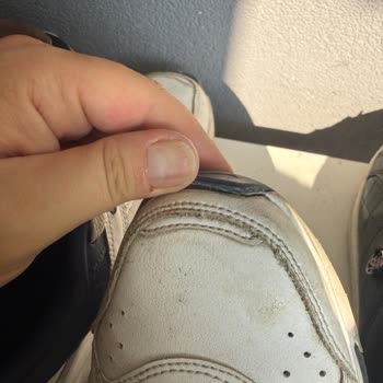 Nike Ayakkabısında Üç Ay Ön Kısım Açılması Ve Mağaza Tarafından Kullanıcı Hatası İddiası