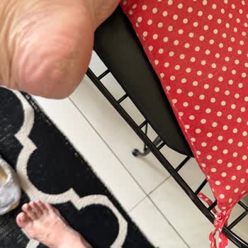 Skechers Sandaleti Ayağımı Yıprattı, İade Hakkım Reddedildi