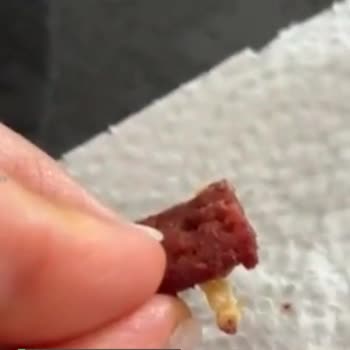 Torku Sucuktan Kıl Çıktı!