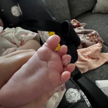 Bebek Sağlığını Tehdit Eden Puset Minderinde Elyaf Dökülmesi