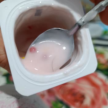 Yoğurtta Kıl Çıktı, Hijyen Ve Sağlık Endişesi