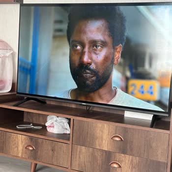 Garanti Kapsamındaki Xiaomi TV’de Dikey Çizgi Sorunu Ve Kayıt Hatası