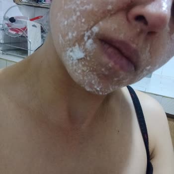 Sinoz Pink Markasına Ait SPF 50 Güneş Kremini Hastanelik Etti