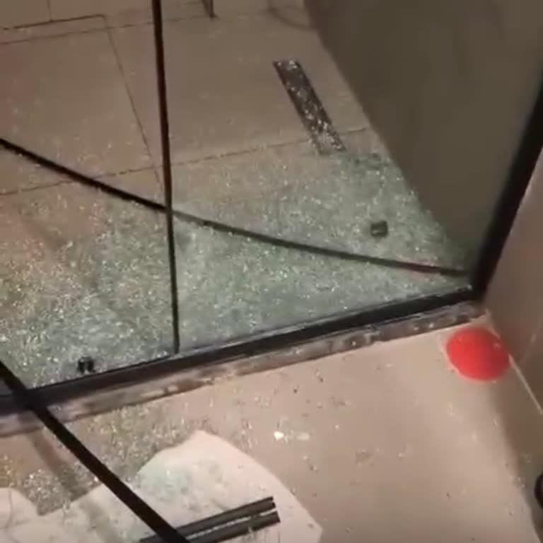 Duşakabin Patlaması Çocuğumu Yaraladı, Otel Yönetimi Çözüm Sunmadı