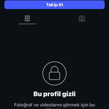 Wearfact Kalitesiz Bir Ürün Gönderildi