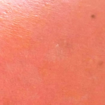 Dear Body Güneş Koruyucu Sprey 30 SPF İle Şiddetli Yanık Ve Ağrı