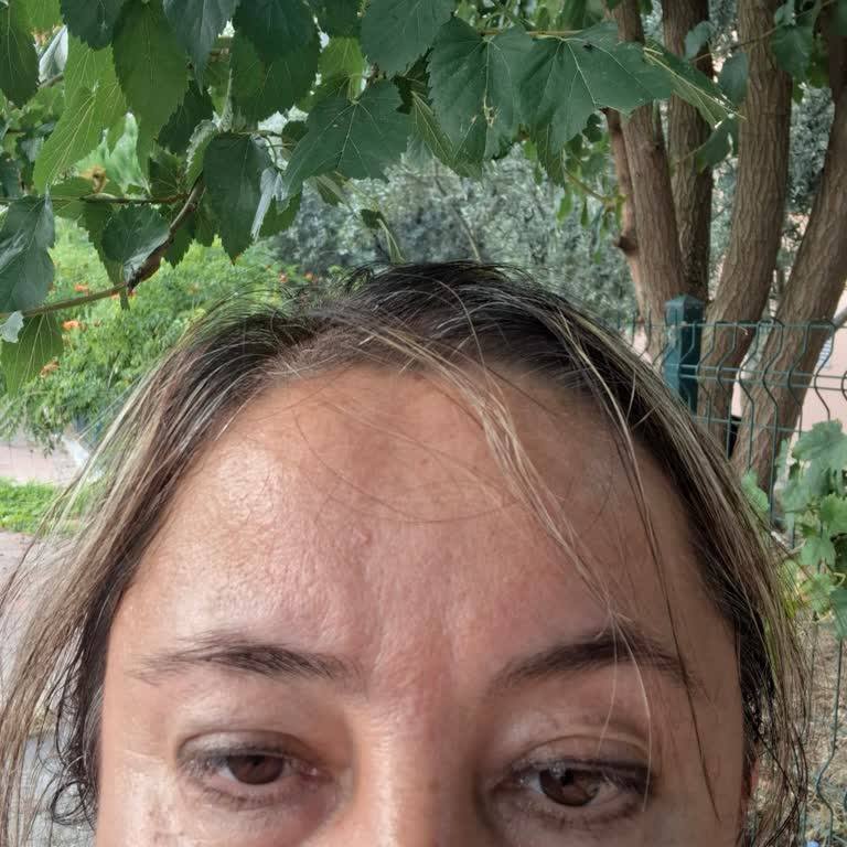İade Ve Fatura Süreçlerindeki Tutarsız Bilgilendirme Ve Göz Rahatsızlığı