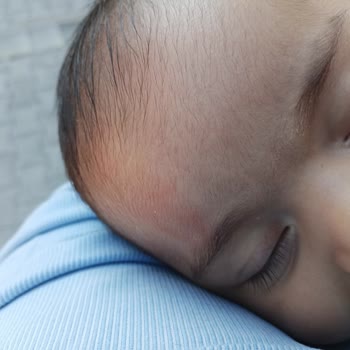 Parça Ayrılan Bebek Arabası Çocuğun Kafasına Çarptı Ve Garanti Çözümü Yetersiz